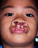 Photo of Analyn