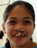 Photo of Corazon