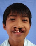 Photo of Randall