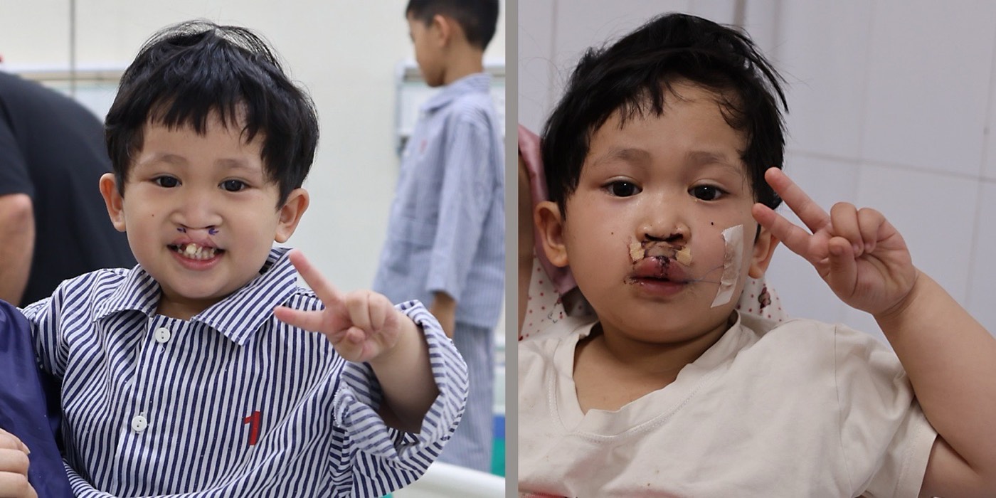Operation Restore Hope on site at the hospital in Hanoi
